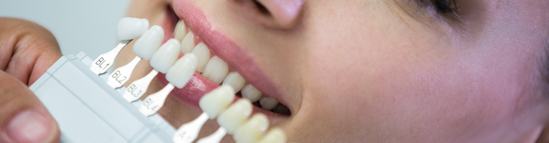 Hand holding tooth shade-matching tool against woman's teeth.